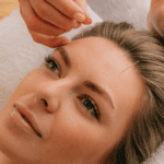 Agopuntura viso | Treatwell