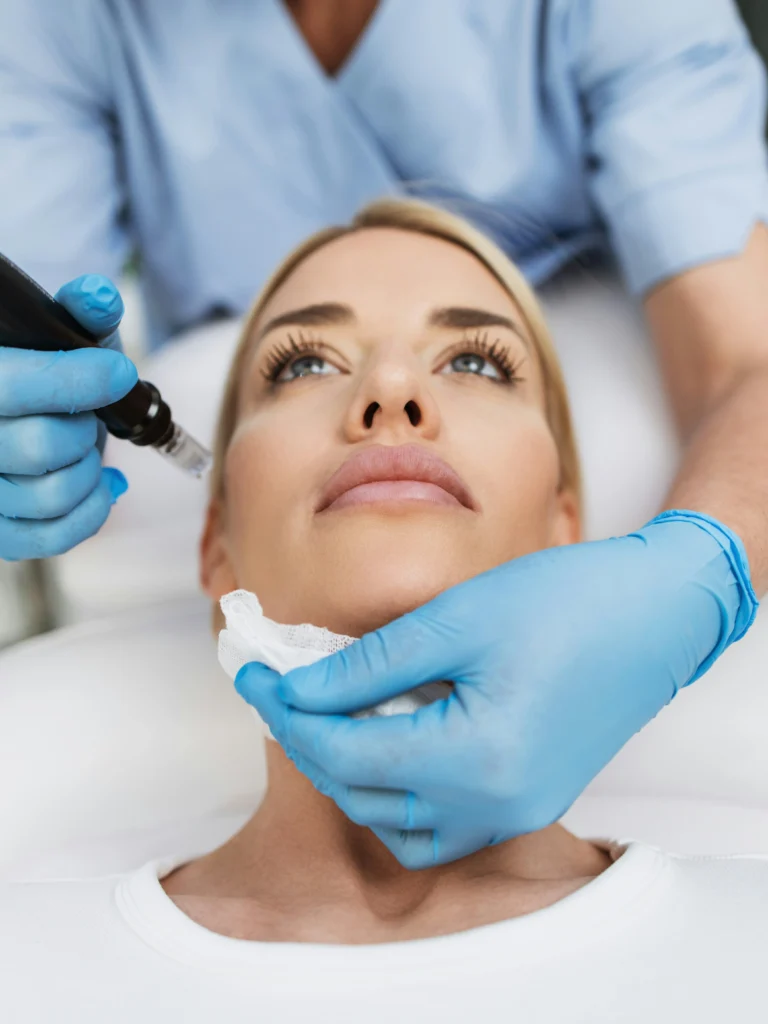 Primo piano del viso di una donna che si rilassa su un lettino mentre riceve un trattamento di microneedling in una clinica