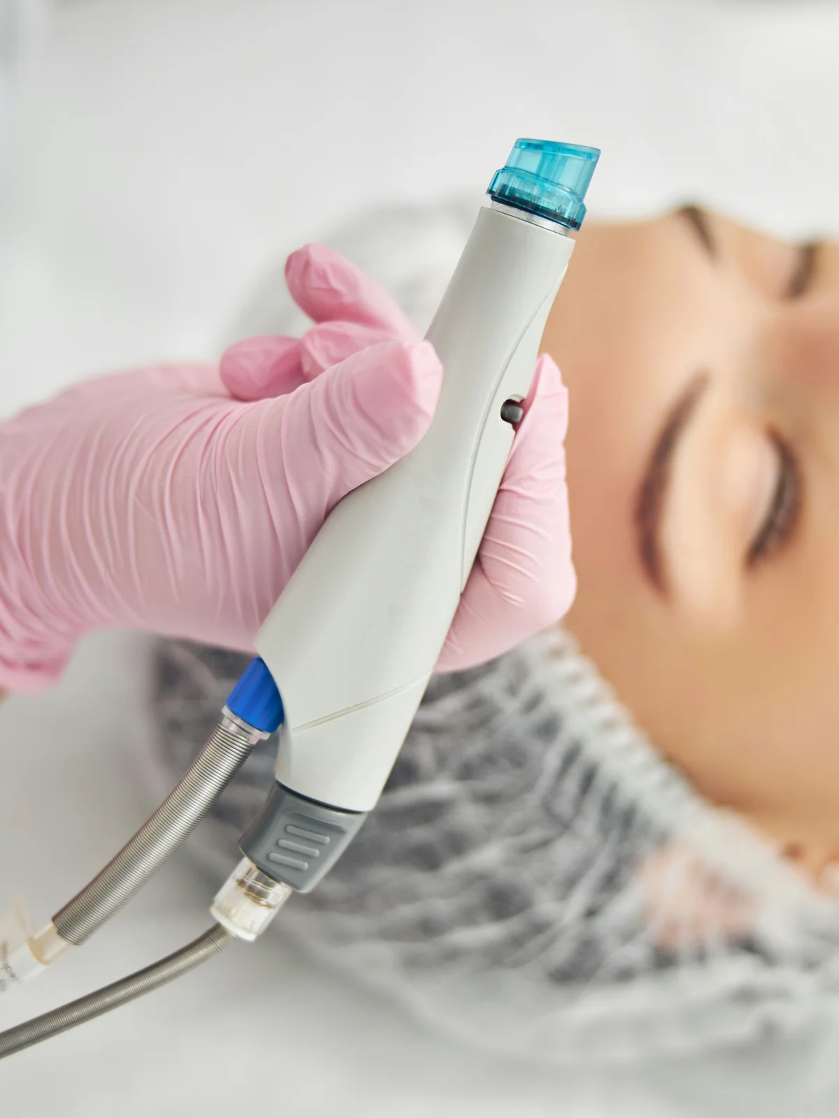 Primo piano di un dispositivo HydraFacial con punta a spirale tenuto in mano da una specialista