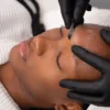Primo piano di un'estetista che esegue il dermaplaning su una cliente in un centro estetico