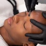 Primo piano di un'estetista che esegue il dermaplaning su una cliente in un centro estetico